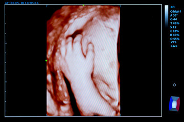 Colourful image of pregnancy ultrasound monitor