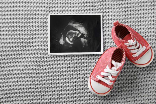 Ultrasound photo of baby and cute boots on knitted blanket, flat lay. Space for text