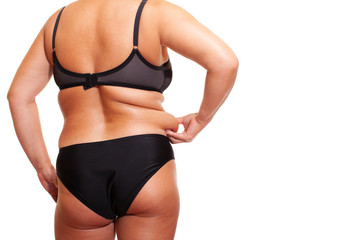 Close-up. Woman's Back is Overweight, folds of Fat. Woman holding a skin Fold at the side of her...