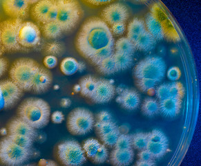 close up petri dish with microbe colony