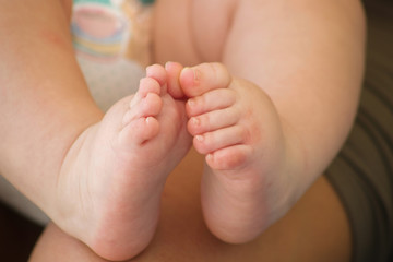 Fototapeta na wymiar new born baby feet with long toenails and skin irritation