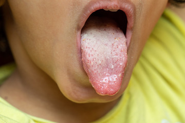 Closeup view of a young child sticking their tongue out