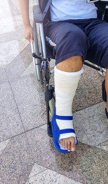 Broken leg in plaster cast. Teenager boy sitting on wheelchair. Injury leg.