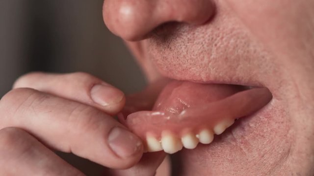 The mouth of an elderly man with false teeth. An older man inserts his upper jaw into his mouth. Grandfather with false teeth. Mouth close up, slow motion, 4K