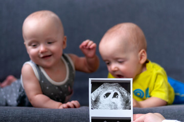 Photo ultrasound twins. In the background are twins, a boy and a girl of 7 months. Maternity.