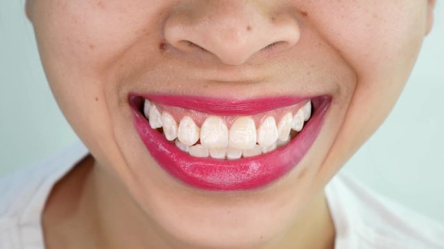 Close up mouth of Asian young woman laughing with white teeth over white background in studio.