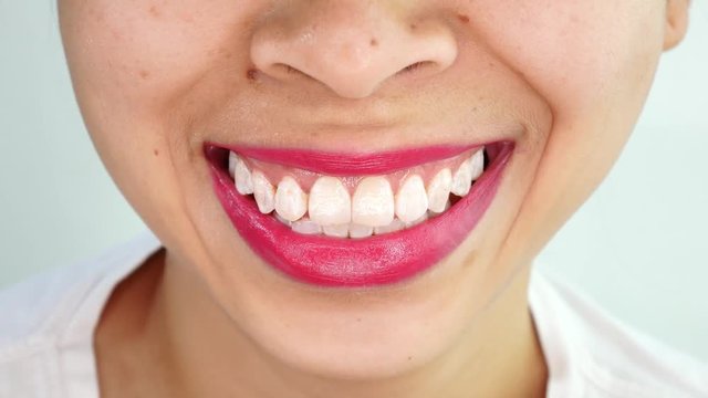 Close up mouth of Asian young woman smiling  with white teeth over white background in studio.