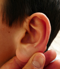 ear inflammation and child ear, aching ear, ear health, close-up ear pictures,