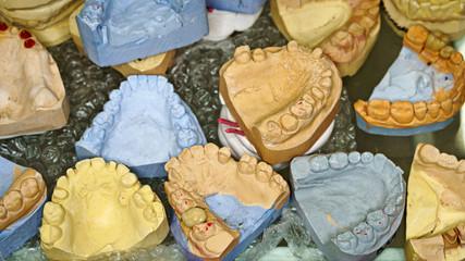 Dental impressions of teeth for manufacture of prostheses and correcting bite. Lot of plaster casts lying on table. © Vagengeim