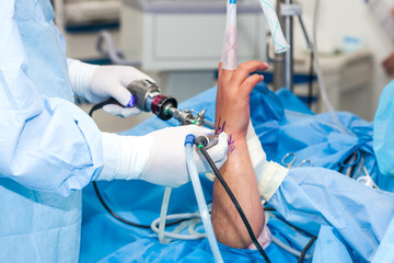 Group of orthopedic surgeons performing a wrist arthroscopy on a male patient