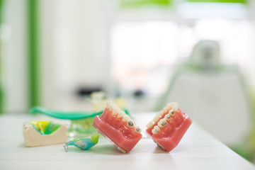 Orthodontic teeth models dental education model jaws with half ceramic and half metal bracket Teeth and Jaw Models.