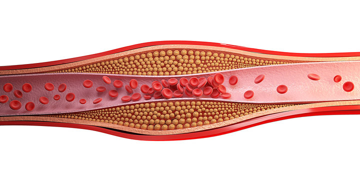 3d rendering cell of red blood clot.
