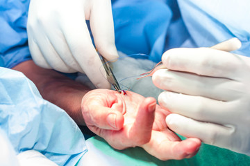 Surgeon suturing the hand of a patient at the end of surgery