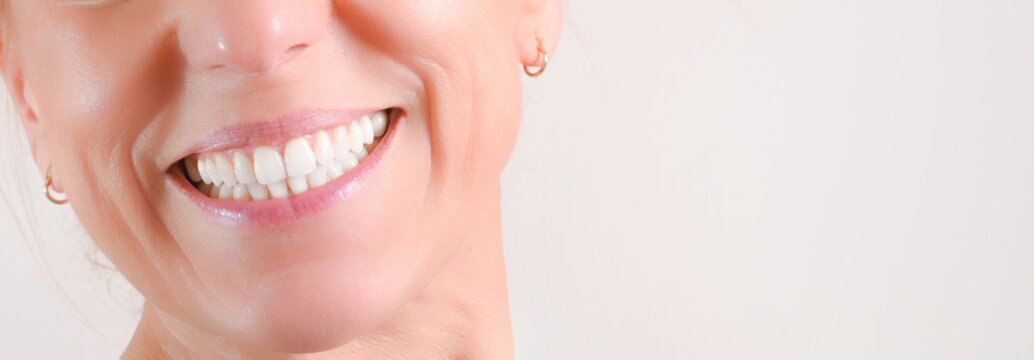 Mature woman showing perfect natural white teeth in front