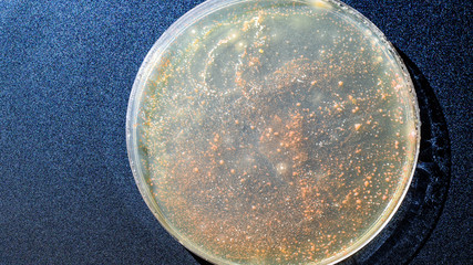 close up petri dish with microbe colony