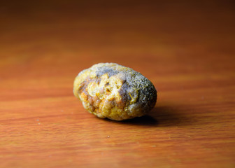 Large gallstone, Gall bladder stone. The result of gallstones