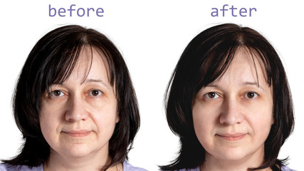 Face of a mature woman with dark hair before and after cosmetic rejuvenating procedures, isolated...