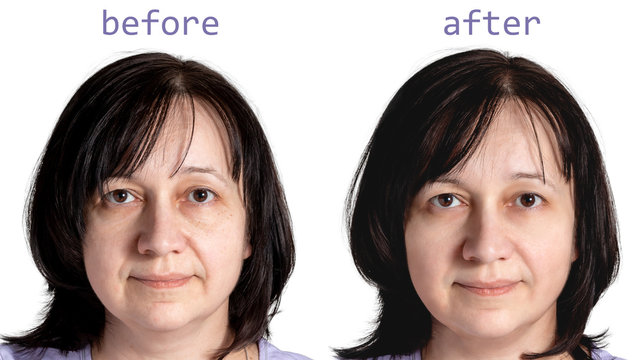 Face of a mature woman with dark hair before and after cosmetic rejuvenating procedures, isolated on white background