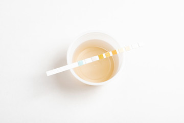 A set of urine sample on a round plastic cup with a single unused urine reagent strip against a...