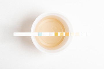 A set of urine sample on a round plastic cup with a single unused urine reagent strip against a plain white background.