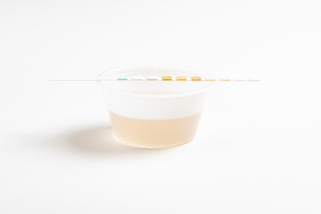 A set of urine sample on a round plastic cup with a single unused urine reagent strip against a...