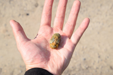 Gallstone in hand, Gall bladder stone. result of gallstones. Calculus of heterogeneous composition