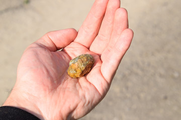 Gallstone in hand, Gall bladder stone. result of gallstones. Calculus of heterogeneous composition