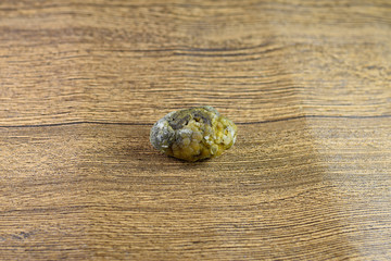 Large gallstone, Gall bladder stone. result of gallstones. Calculus of heterogeneous composition