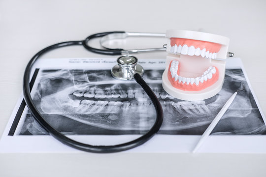 Dental model and equipment on tooth x-ray film and stethoscope used in the treatment of dental and dentistry by dentist
