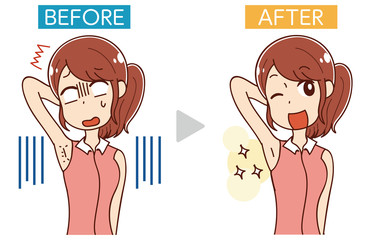 イラスト素材: エステ・女性のムダ毛処理・ビフォーアフター