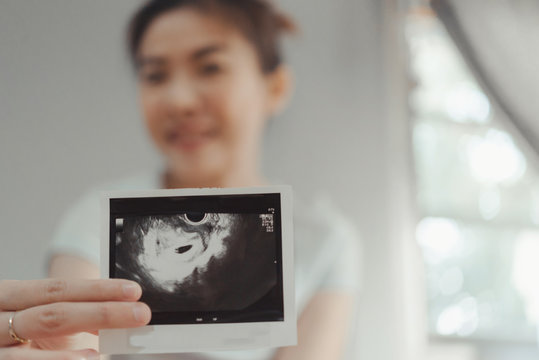 Young pregnant woman looking at 4 Weeks x-ray ultrasound scan of baby