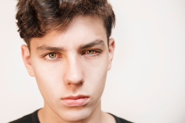 A boy of an adolescent age with a sick red eye on a light background. The boy hurt his eyes because he was ill with conjunctivitis - obrazy, fototapety, plakaty