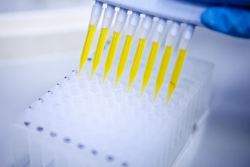 Test tubes in the laboratory with a yellow liquid