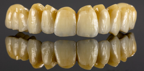 Denti in zirconio e ceramica integrale