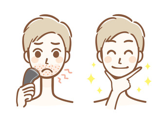 カミソリ負け　脱毛　男性　ビフォーアフター