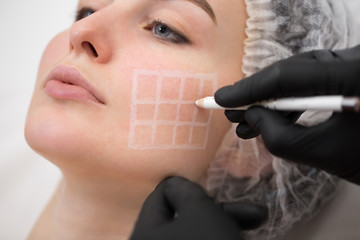 Beautician draws the contours of a white pencil on the face of the patient. Schematic marking before contouring. Close-up preparation of the face for cosmetic plastic surgery