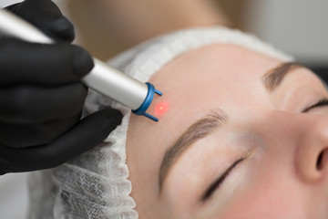 Close-up removal of blood vessels on the face of a diode laser in a cosmetic clinic. Therapist...