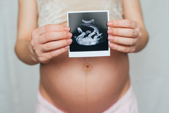 photo ultrasound in the hands of a pregnant girl on a belly background