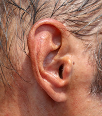 Ear on the head of an old man