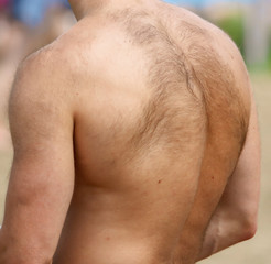 Man with hair on his back