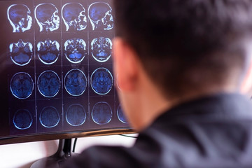 Doctor radiologist in hospital looking at x-ray mri scan of brain, head and skull ct scanning on...