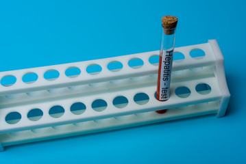 Hepatitis test, Blood in the test Tube.