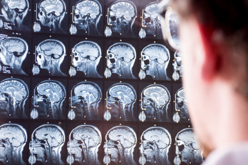 MRI scan of head and brain. Doctor in foreground with blurred silhouette looks at magnetic...
