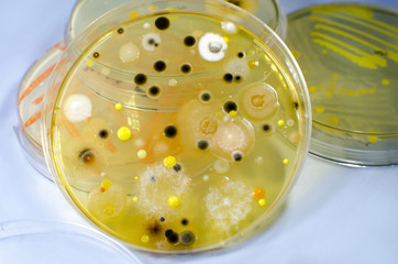Colonies of different bacteria and mold fungi grown on Petri dish with nutrient agar, close-up view. Microbiology background