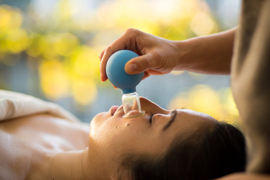 Young Woman receiving facial rejuventation cupping  in spa wellness center