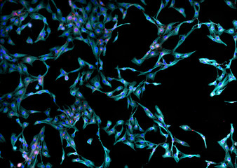 Real fluorescence microscopic view of human skin fibroblasts