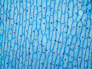 Onion epithelium.