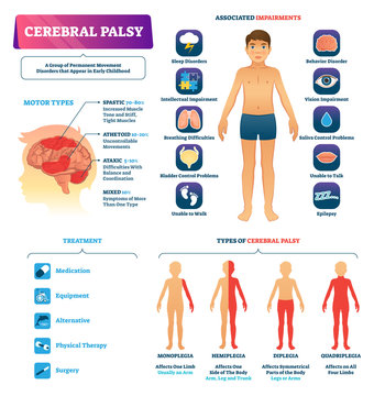 Cerebral palsy vector illustration. Permanent movement disorder type scheme