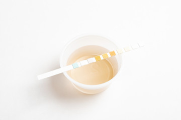 A combination of urine sample in a small round plastic container with a urine reagent strip deliberately and artistically set on a plain white background.