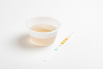 A combination of urine sample in a small round plastic container with a urine reagent strip deliberately and artistically set on a plain white background.